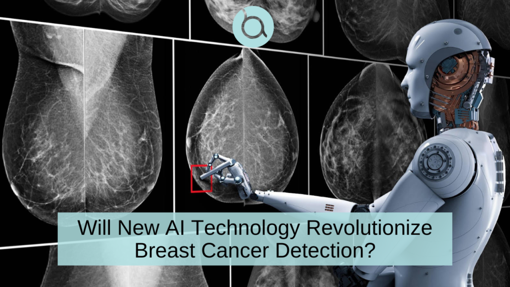 AI may better predict breast cancer risk and diagnose breast cancers earlier